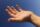 Lesiones de la mano