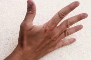Tendones extensores