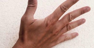 Tendones extensores