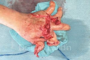 Destrucción de la mano por máquina corta-césped