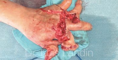 Destrucción de la mano por máquina corta-césped
